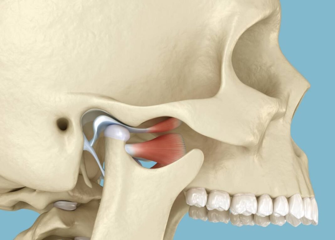 How to Cure TMJ Permanently