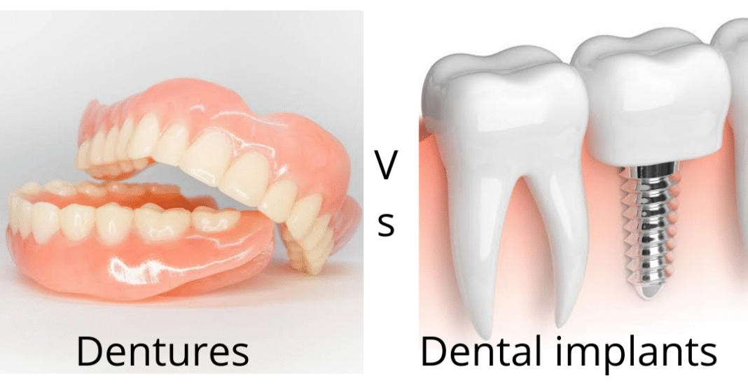 Dentures