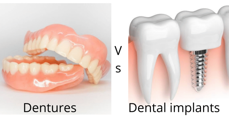 Implant Dentures vs Traditional Dentures: Which is Right for You?