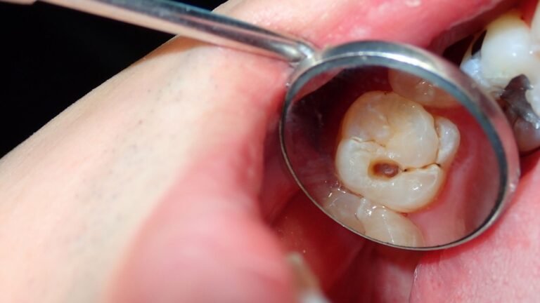 How to Handle Swelling or Infection Around an Implant Post-Surgery