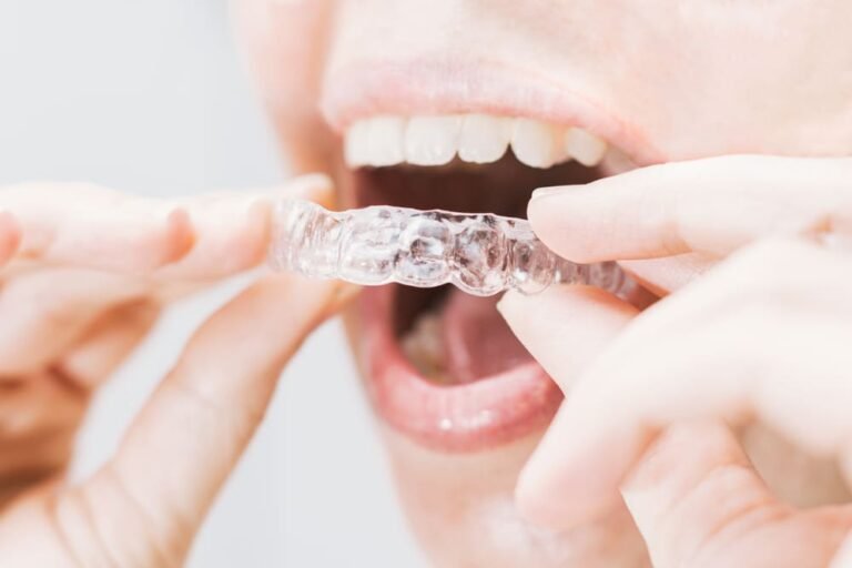 How to Manage Tooth Pain or Pressure During Invisalign Treatment